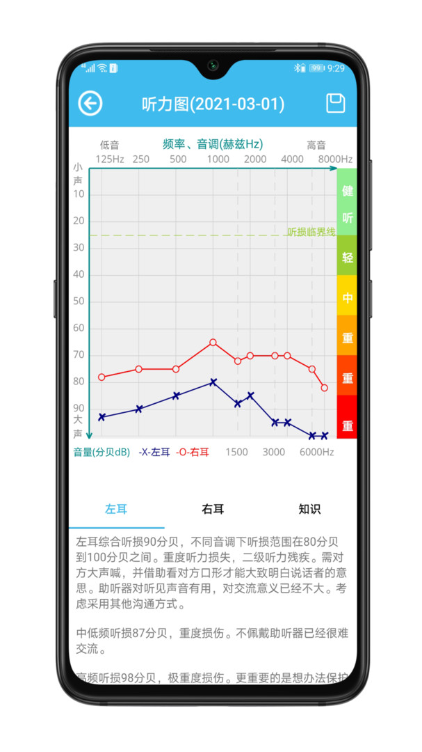 见声听力检测