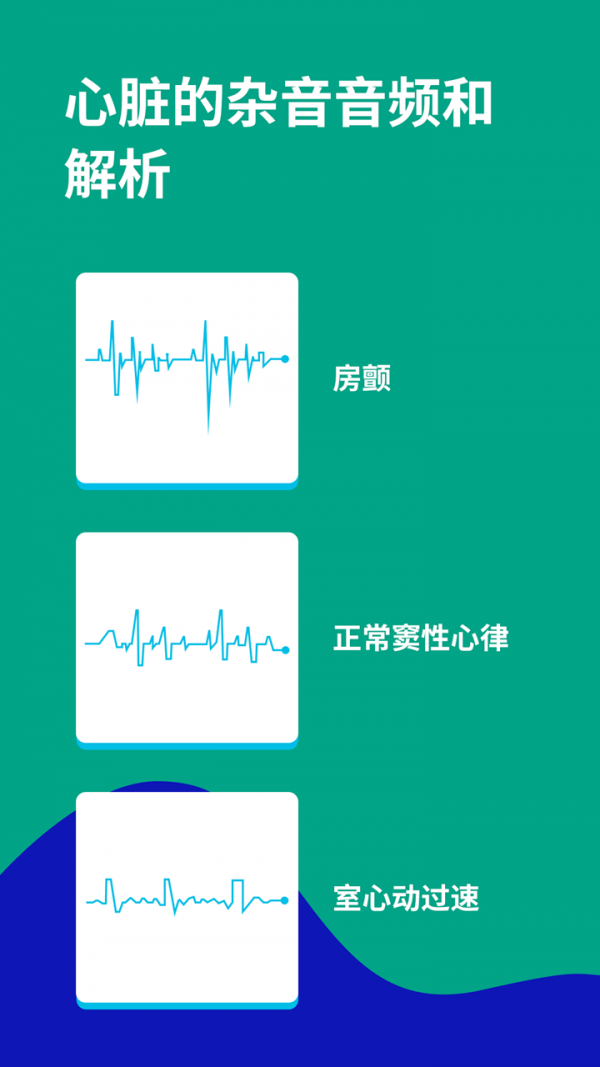 心电图ECG