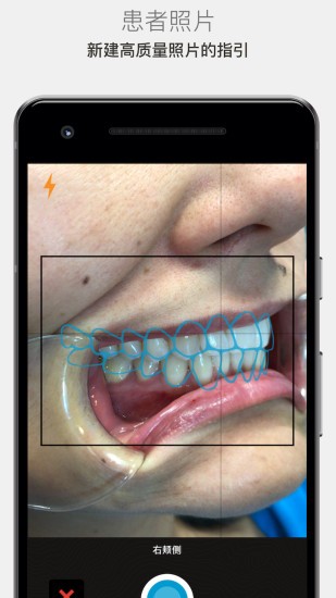 Invisalign Photo Uploader软件(照片上传应用)