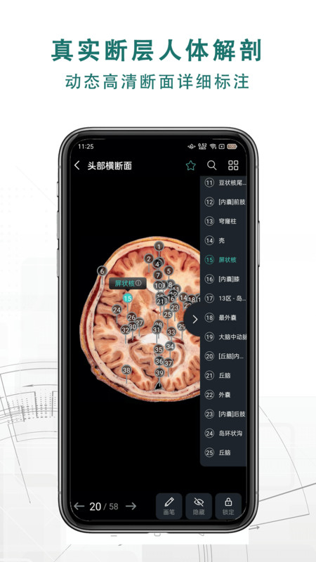 掌上3D解剖安卓版v2.7.6APP截图